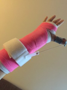 Wake up thumb, it's time to stretch!